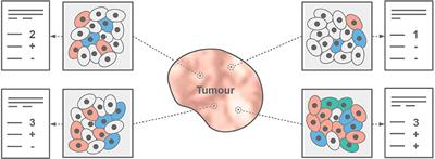 Personalizing Medicine Through Hybrid Imaging and Medical Big Data Analysis